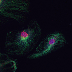Dual Staining of Endothelial Cells for Vimentin in Green and Nuclear Pore Complex in Red